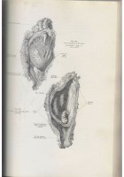 TRATTATO COMPLETO DI OSTETRICIA di Ernesto Bumm 1909 Società editrice libraria