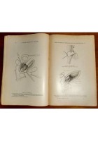 LA PRATIQUE CHIRURGICALE ILLUSTREE di Victor Pauchet 1930 cancro utero illustrat