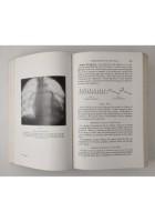 THE PRINCIPLES AND PRACTICE OF MEDICINE di Stanley Davidson 1968 ELBS libro