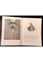 ATLANTE TECNICA OPERAZIONI CHIRURGICHE volume 3 di A Ciminata 1939 Hoepli Libro