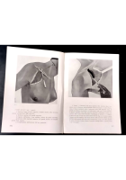 ATLANTE TECNICA OPERAZIONI CHIRURGICHE volume 3 di A Ciminata 1939 Hoepli Libro