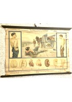 L'ALCOOLISMO lesioni organiche POSTER DIDATTICO Vintage Tavola Mondadori anni 30