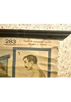 L'ALCOOLISMO lesioni organiche POSTER DIDATTICO Vintage Tavola Mondadori anni 30