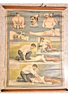 EMORRAGIA ASFISSIA POSTER DIDATTICO Vintage Tavola Paravia anni 30 infermieri