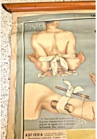 EMORRAGIA ASFISSIA POSTER DIDATTICO Vintage Tavola Paravia anni 30 infermieri