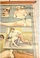 EMORRAGIA ASFISSIA POSTER DIDATTICO Vintage Tavola Paravia anni 30 infermieri